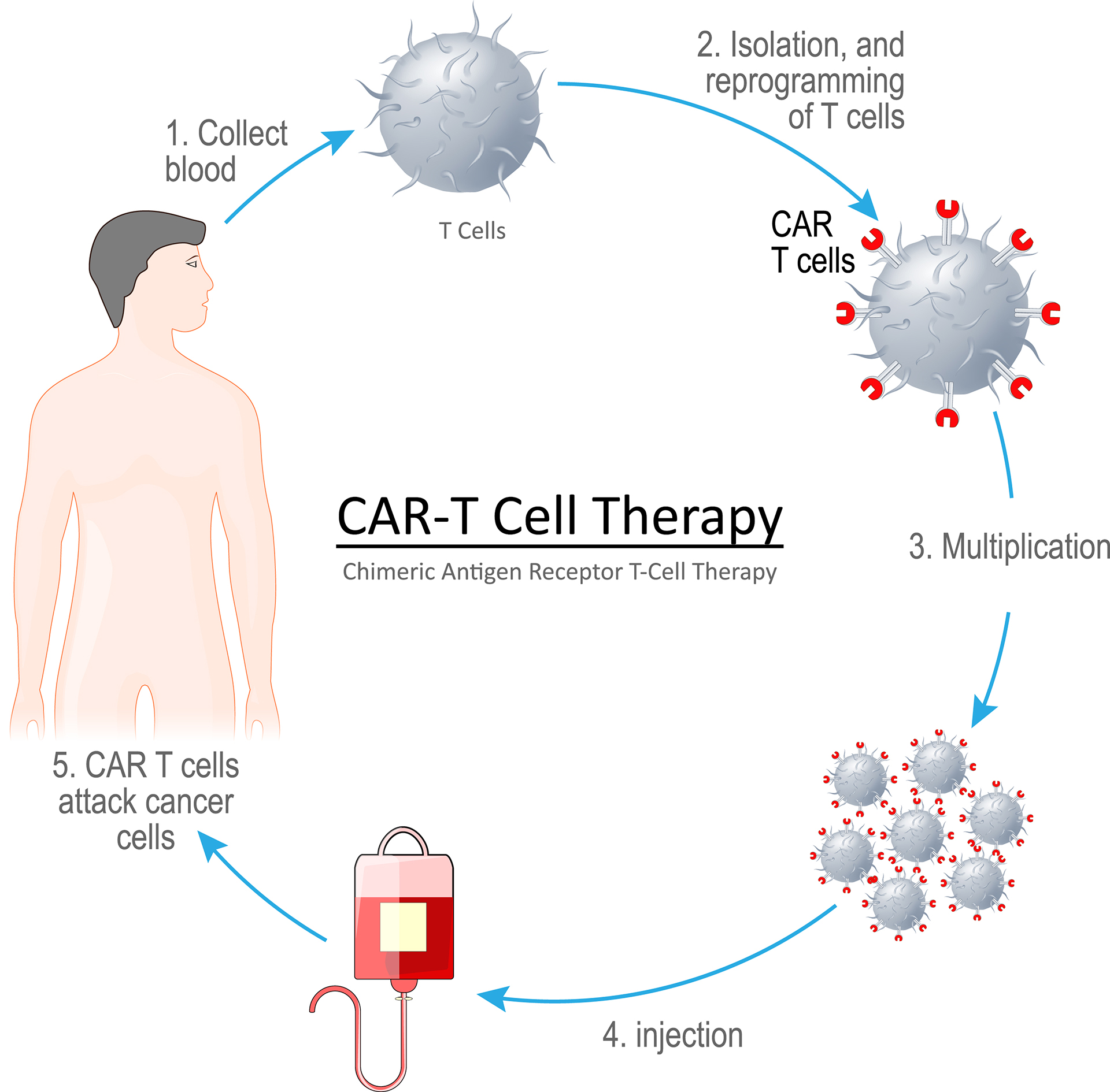 CAR-T Cell Therapy