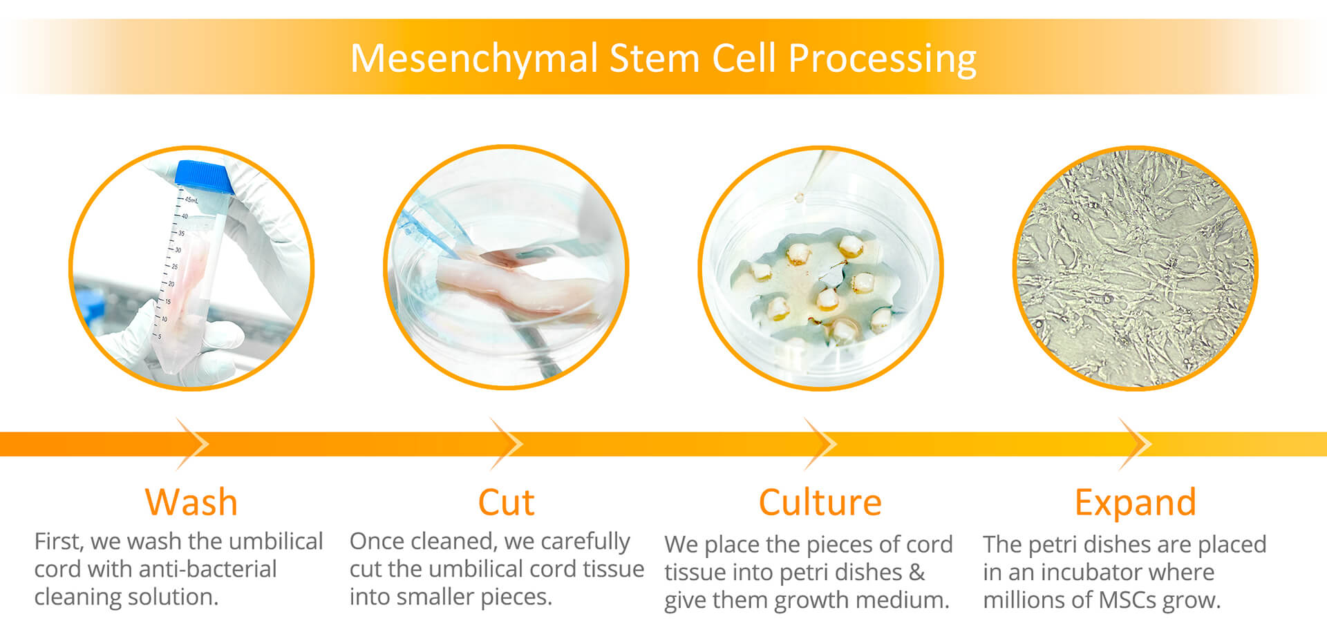 Mesenchymal Stem Cells