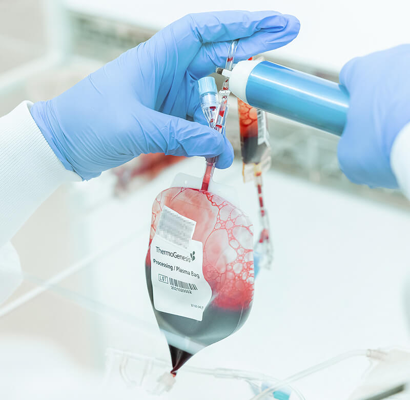 cord-blood-processing