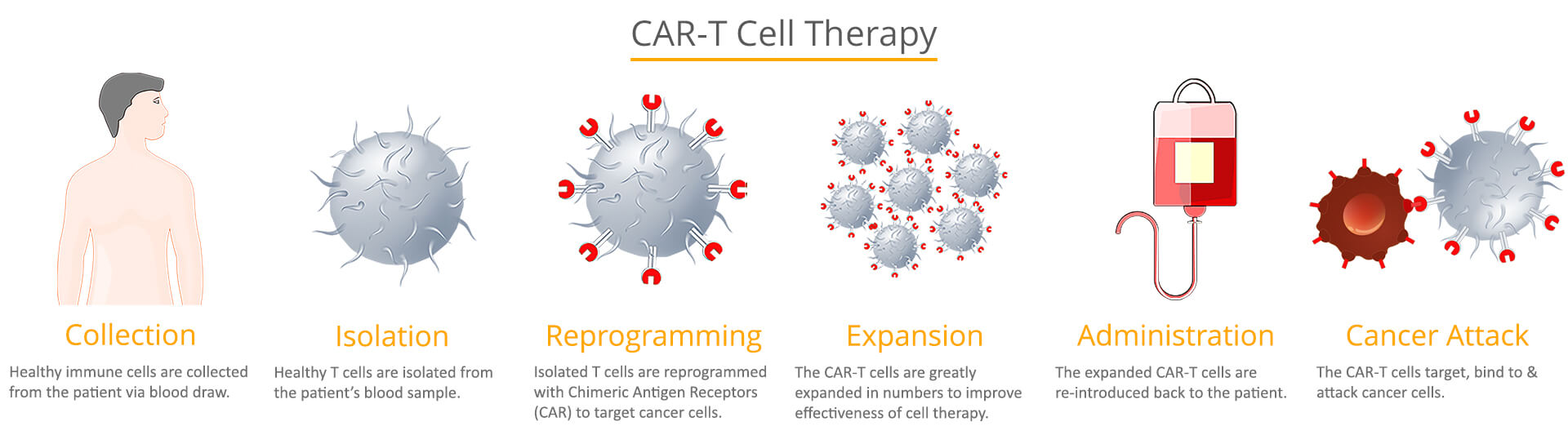 CAR-T cell therapy Immunotherapy